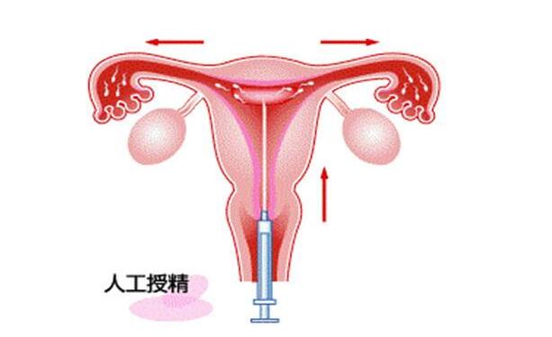 胎位不正