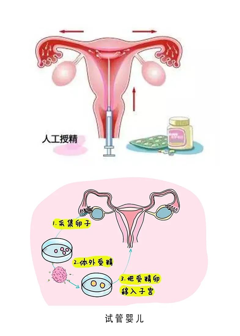 四十年产权
