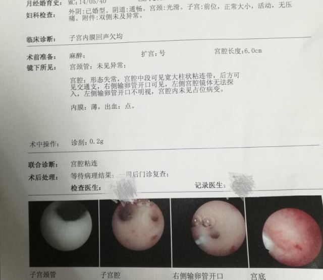国产婴儿奶粉