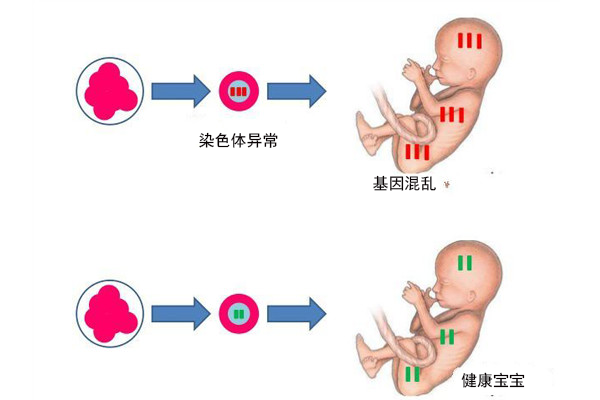 国外孕妇